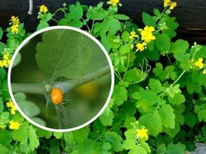 Zume de herbas de celidonia para o tratamento das verrugas plantares